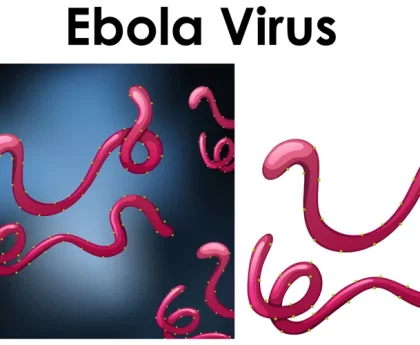 Ebola Virus: Types, Symptoms, Causes & Remedies